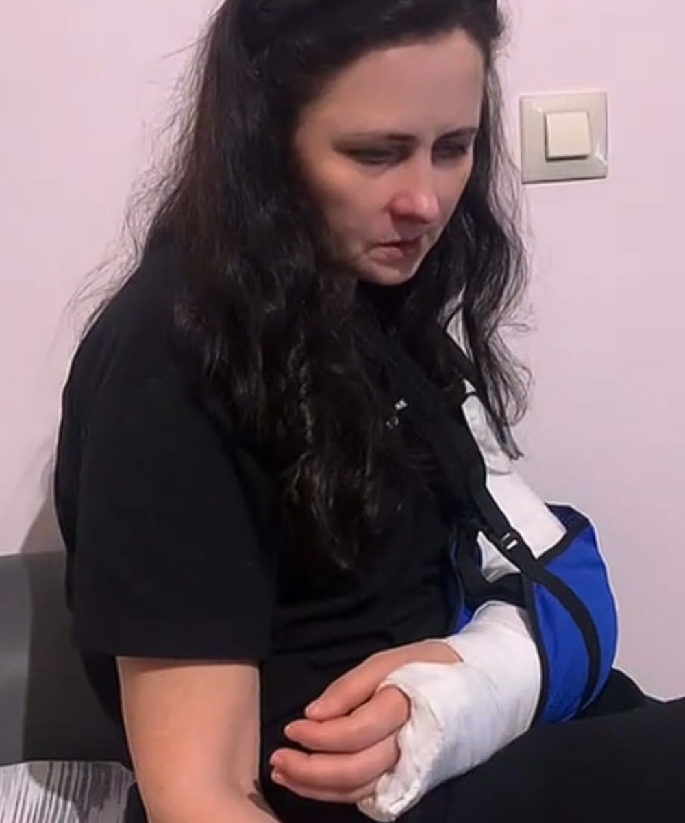 перелом руки у женщины